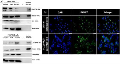 Vitamin D Reverts the Exosome-Mediated Transfer of Cancer Resistance to the mTOR Inhibitor Everolimus in Hepatocellular Carcinoma